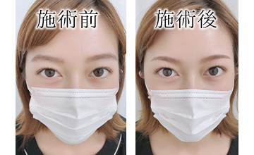 サンプルイメージ